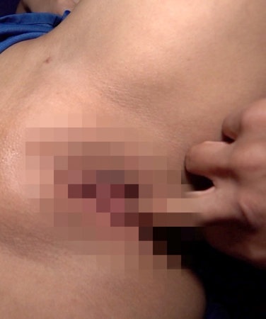 CKJ-382 